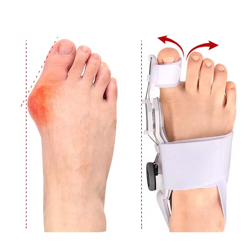 Bunion Corrector / Orthopedic Toe Straightener