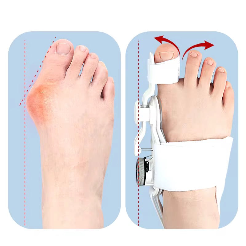 Bunion Corrector / Orthopedic Toe Straightener